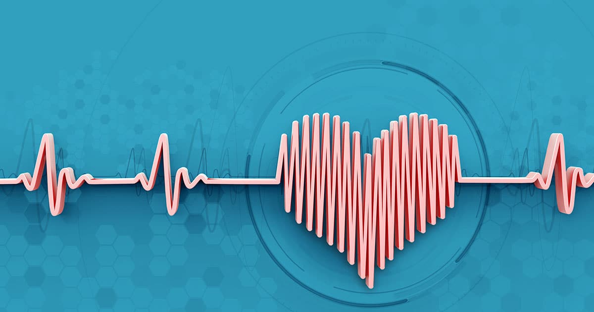 Heartbeat monitoring graphic